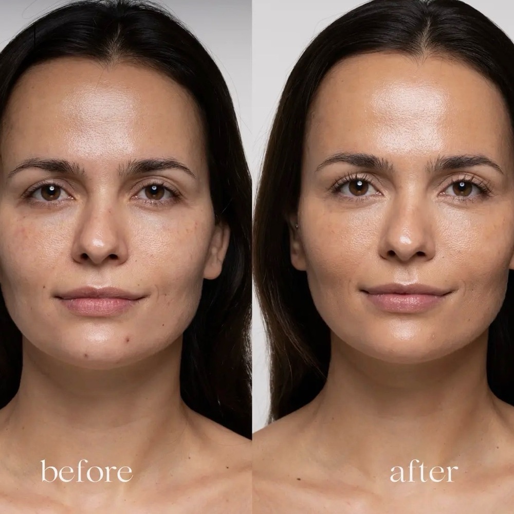Epiclight‎ Luminizing glow gel BNIB - Picture 11 of 11